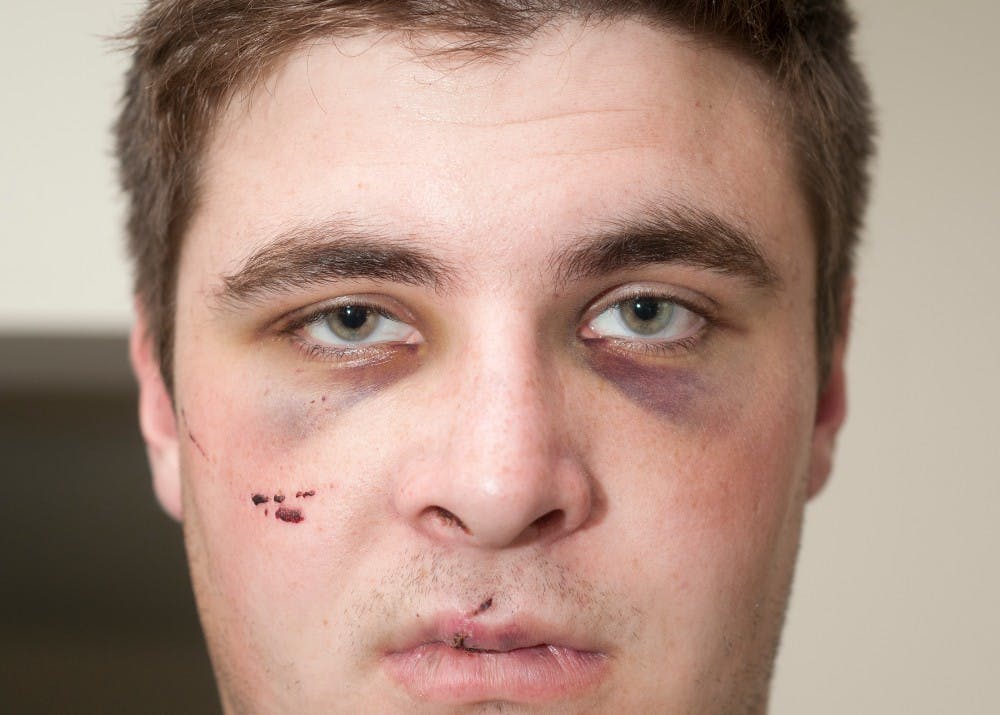 Advertising junior Brandon Carmack in a photo taken on Saturday, Sept. 1, 2012. He was allegedly kicked, stabbed and beat by personals associated with the MSU hockey team. Natalie Kolb/The State News