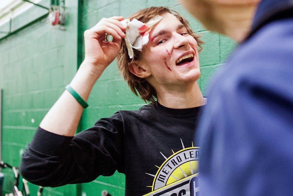 Fishery and wildlife junior Dan Ryan shows MSU spokesman Kent Casella his injury after a bike polo game, Friday, March 1, 2013, at IM Sport-West. Justin Wan/The State News