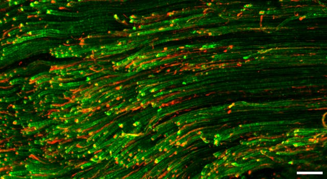 Іmmunofluorescence_image_of_myelinated_A-fibers_and_unmyelinated_C-fibers_in_sciatic_nerve_of_rat.png