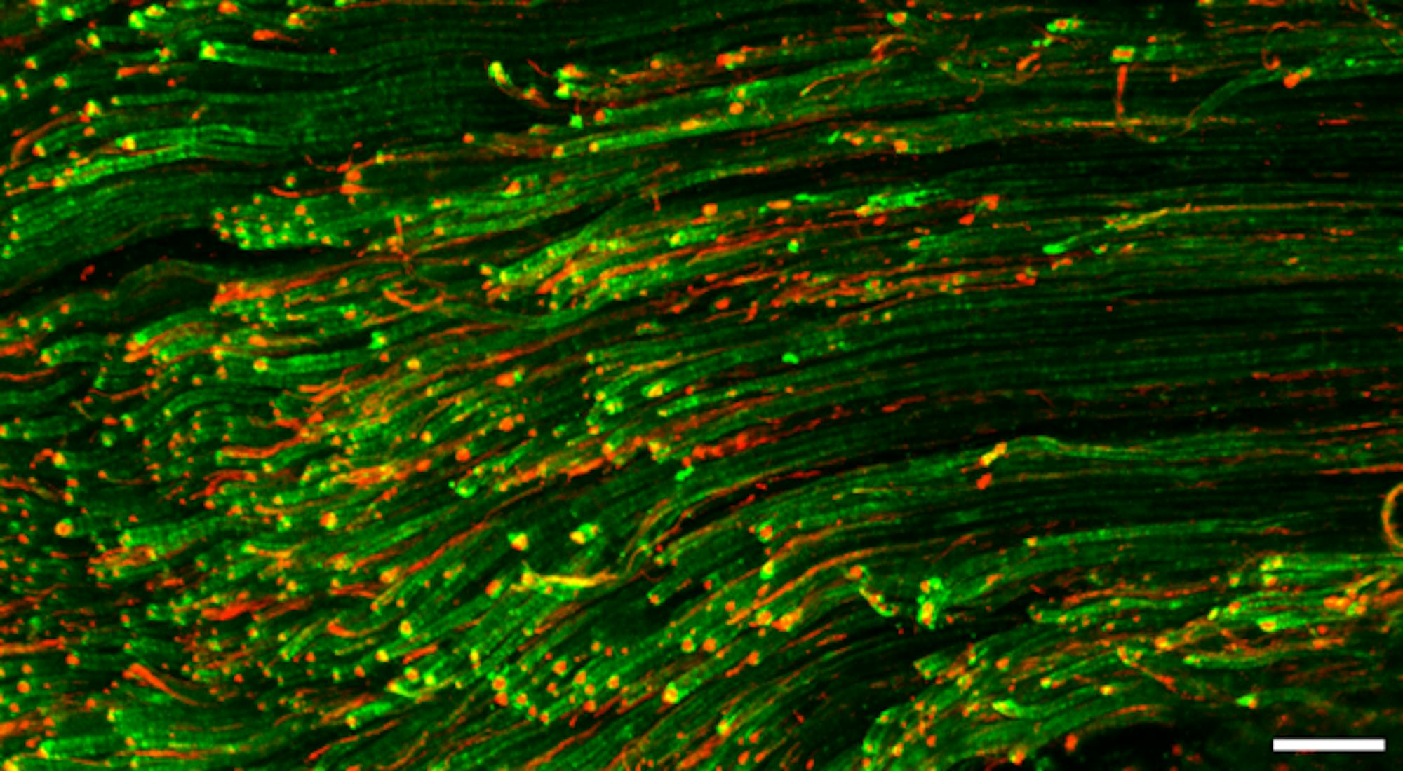 Іmmunofluorescence_image_of_myelinated_A-fibers_and_unmyelinated_C-fibers_in_sciatic_nerve_of_rat.png