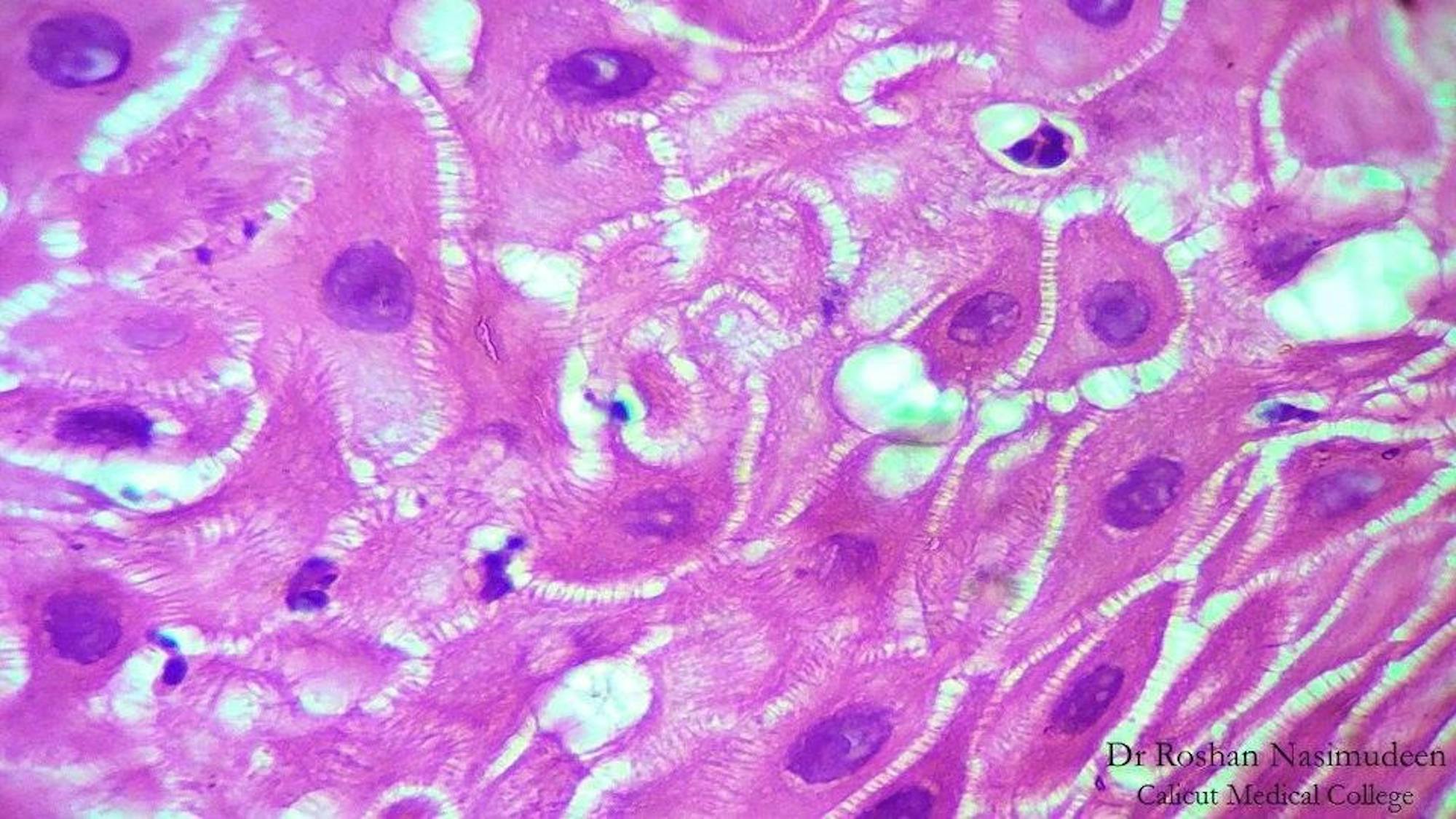 Keratinocytes_in_spinous_layer_of_epidermis.jpg