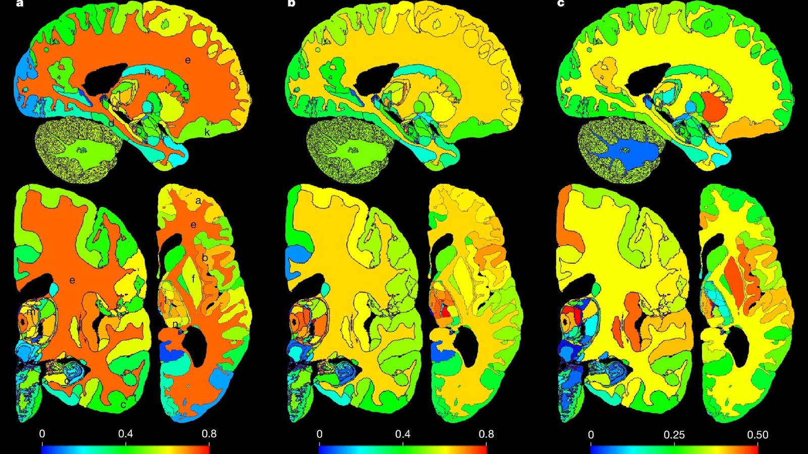 NextBrain: An AI-powered brain atlas - The Tufts Daily