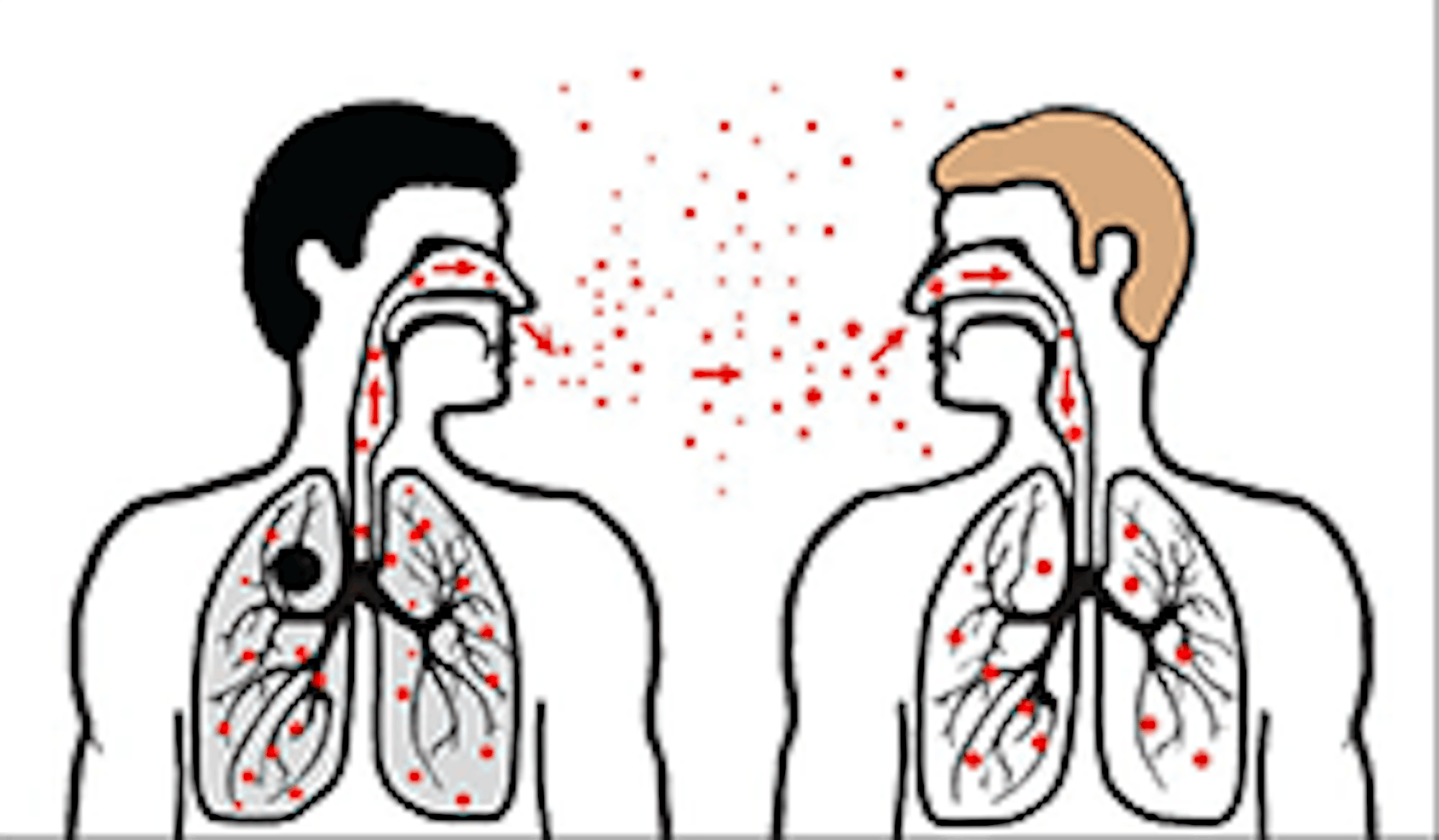 A graphic depicting disease transmission via sneezing is pictured..png