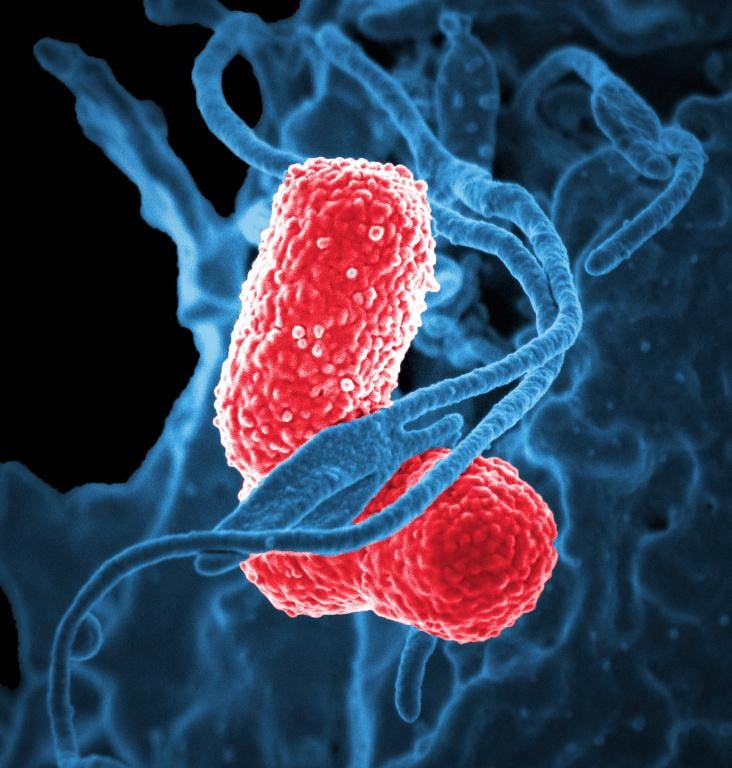 Multidrug-resistant_Klebsiella_pneumoniaeand_neutrophil.jpg