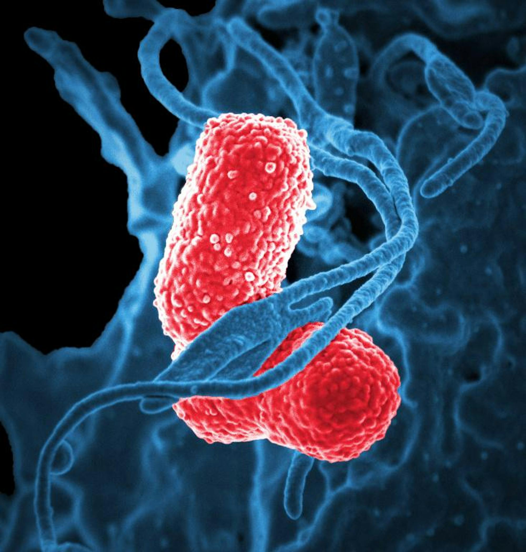 Multidrug-resistant_Klebsiella_pneumoniaeand_neutrophil.jpg