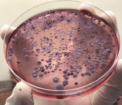 This image shows Burkholderia Pseudomallei, a bacteria which leads to infections including melioidosis. Researchers screened over 200,000 molecules to determine which can kill and control the spread of the bacteria.