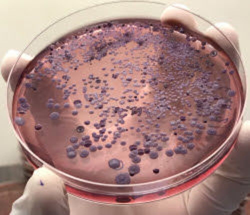 <div>This image shows Burkholderia Pseudomallei, a bacteria which leads to infections including melioidosis. Researchers screened over 200,000 molecules to determine which can kill and control the spread of the bacteria.</div>