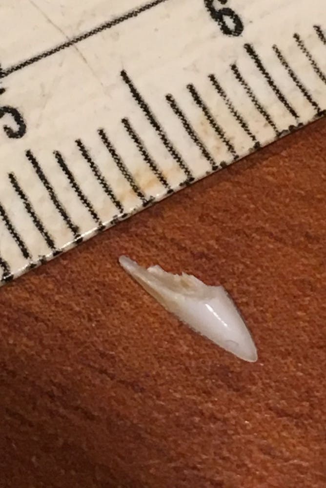 The tooth he removed from his foot in 2018 before he sent it to Gavin Naylor at FLMNH. The tooth was measured at a half centimeter long.