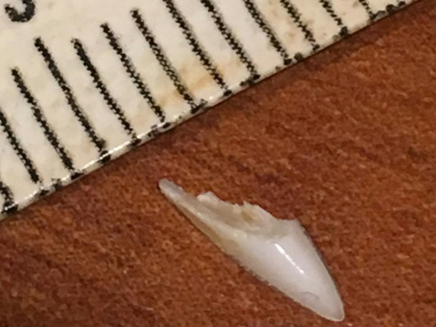 The tooth he removed from his foot in 2018 before he sent it to Gavin Naylor at FLMNH. The tooth was measured at a half centimeter long.