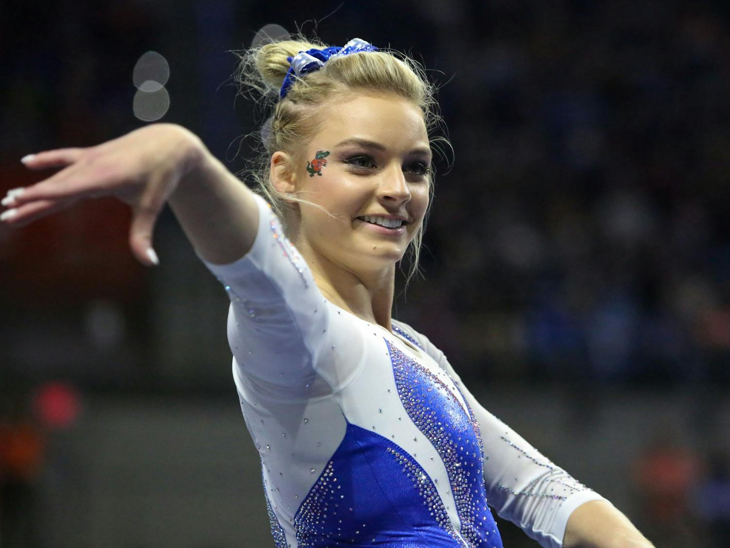 UF gymnast Alyssa Baumann was taken to Shands Hospital for a precautionary evaluation after falling off the uneven bars in practice. 