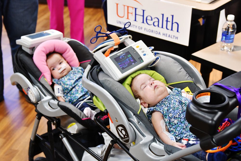 Savannah (left) and Scarlett, once conjoined twins, are separated for the first time after 12 procedures.