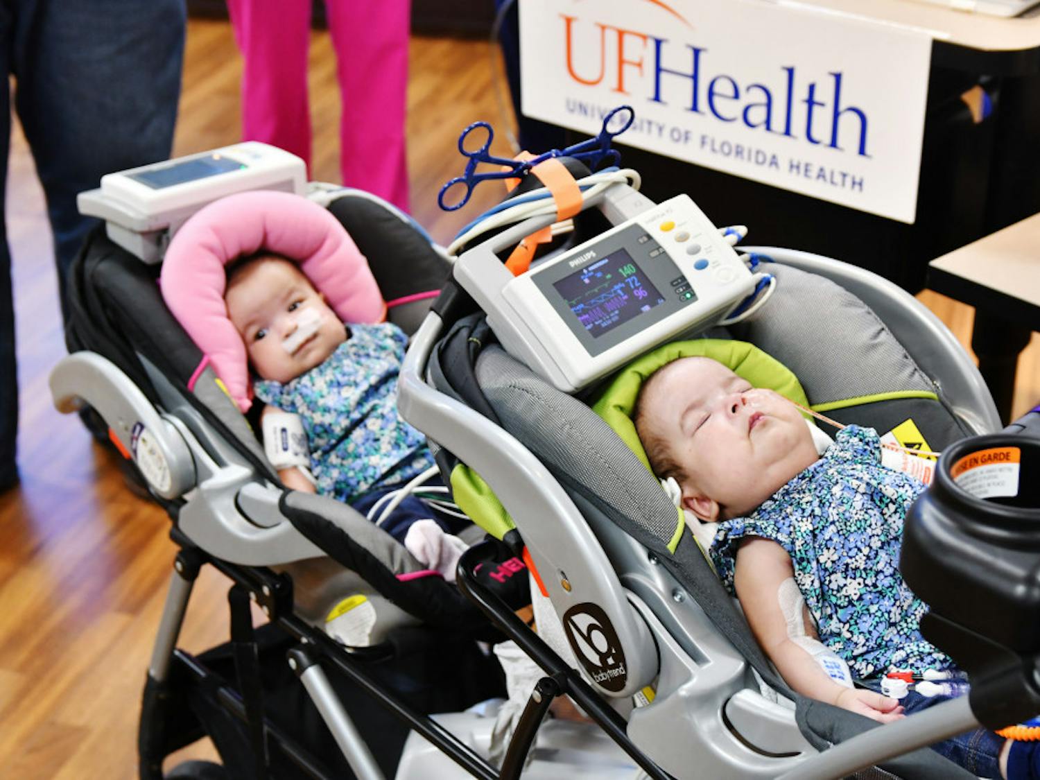 Savannah (left) and Scarlett, once conjoined twins, are separated for the first time after 12 procedures.