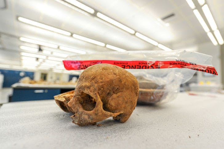 A skull confiscated in Fort Lauderdale from travelers incoming from Cuba was suspected to have been used in voodoo ceremonies. It is part of the C.A. Pound Human Identification Laboratory’s collections. &nbsp;