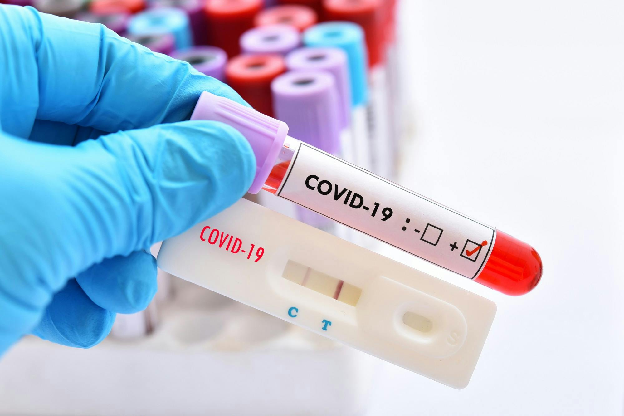 The Health and Counseling Center is offering free COVID-19 testing for UP students in Oregon. Photo illustration courtesy of Adobe Images.
