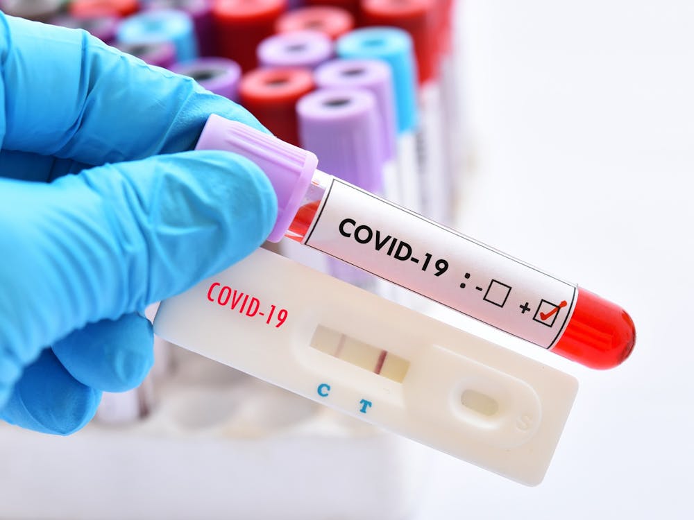 The Health and Counseling Center is offering free COVID-19 testing for UP students in Oregon. Photo illustration courtesy of Adobe Images.